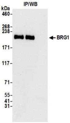 Immunoprecipitation: Brg1 Antibody (BLR106H) [NBP3-14696]
