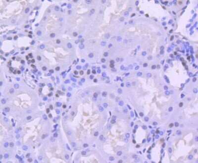 Immunohistochemistry: Brg1 Antibody (SN20-03) [NBP2-74964]