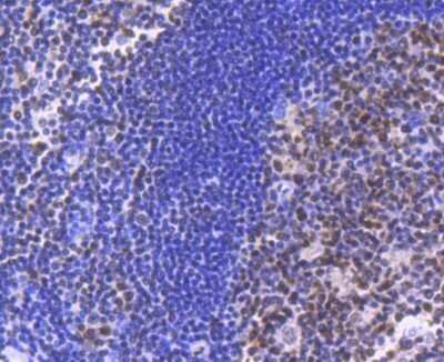 Immunohistochemistry: Brg1 Antibody (SN20-03) [NBP2-74964]