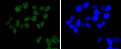 Immunocytochemistry/ Immunofluorescence: Brg1 Antibody (SN20-03) [NBP2-67720]