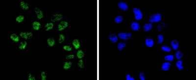 Immunocytochemistry/ Immunofluorescence: Brg1 Antibody (SN20-03) [NBP2-67720]