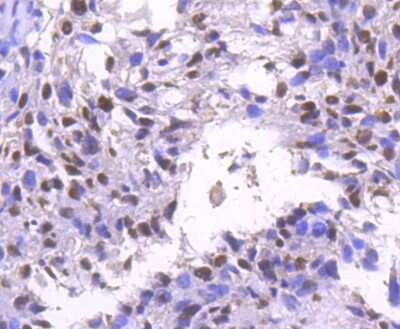 Immunohistochemistry-Paraffin: Brg1 Antibody (SN20-03) [NBP2-67720]