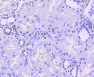 Immunohistochemistry-Paraffin: Brg1 Antibody (SN20-03) [NBP2-67720]