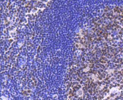 Immunohistochemistry-Paraffin: Brg1 Antibody (SN20-03) [NBP2-67720]