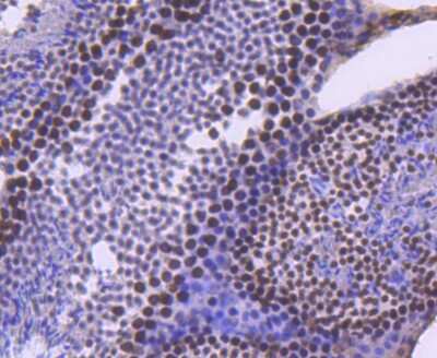 Immunohistochemistry-Paraffin: Brg1 Antibody (SN20-03) [NBP2-67720]