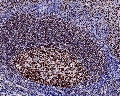 Immunohistochemistry-Paraffin: Brg1 Antibody (SN20-03) [NBP2-67720]