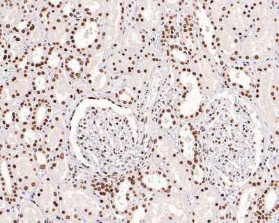 Immunohistochemistry-Paraffin: Brg1 Antibody (SN20-03) [NBP2-67720]