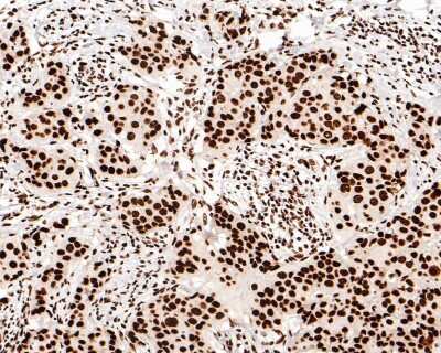Immunohistochemistry-Paraffin: Brg1 Antibody (SN20-03) [NBP2-67720]