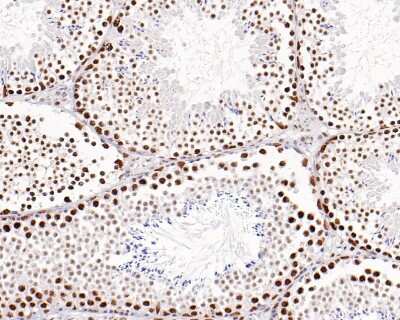 Immunohistochemistry-Paraffin: Brg1 Antibody (SN20-03) [NBP2-67720]