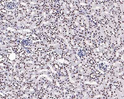Immunohistochemistry-Paraffin: Brg1 Antibody (SN20-03) [NBP2-67720]