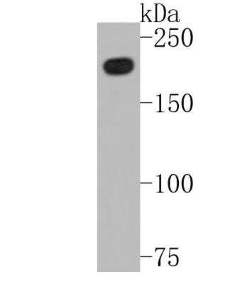 Western Blot: Brg1 Antibody (SN20-03) [NBP2-67720]