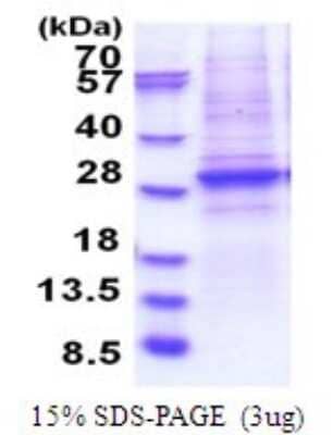 SDS-PAGE: Recombinant Human Brg1 His Protein [NBP2-51811]