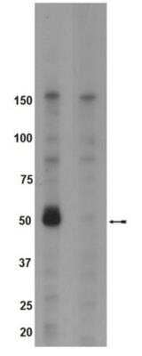 Western Blot: Brk [p Tyr342] Antibody [NBP2-29687]