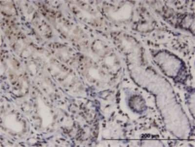 Immunohistochemistry-Paraffin: Brk Antibody (2F11) [H00005753-M01]