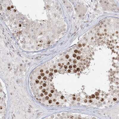 Immunohistochemistry-Paraffin: Brk Antibody [NBP1-89935]