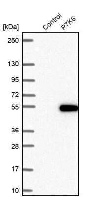 Western Blot: Brk Antibody [NBP1-89936]