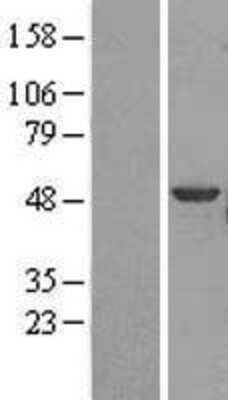 Western Blot: Brk Overexpression Lysate [NBL1-14954]