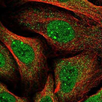 Immunocytochemistry/ Immunofluorescence: Brp16 Antibody [NBP2-54697]