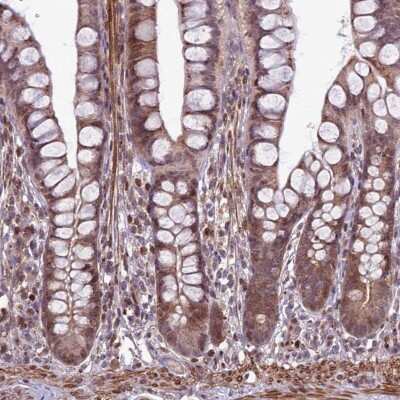 Immunohistochemistry-Paraffin: Brp16 Antibody [NBP2-54697]