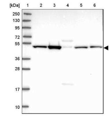 Western Blot: Brp16 Antibody [NBP2-54697]