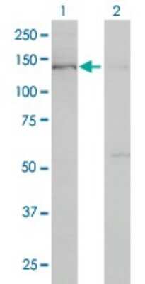 Western Blot: Bub1 Antibody (2F9) [H00000699-M02]