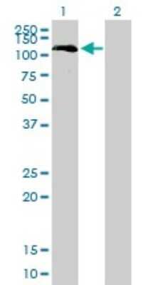 Western Blot: Bub1 Antibody (4C3-4C9) [H00000699-M01]