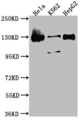 Western Blot: Bub1 Antibody (9C11) [NBP3-15170]