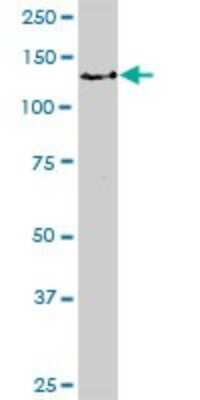 Western Blot: Bub1 Antibody [H00000699-D01P]