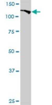 Western Blot: Bub1 Antibody [H00000699-D01P]