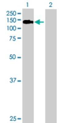 Western Blot: Bub1 Antibody [H00000699-D01P]