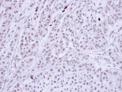 Immunohistochemistry-Paraffin: Bub3 Antibody [NBP1-33558]