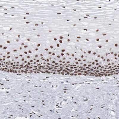 Immunohistochemistry-Paraffin: Bub3 Antibody [NBP1-88517]
