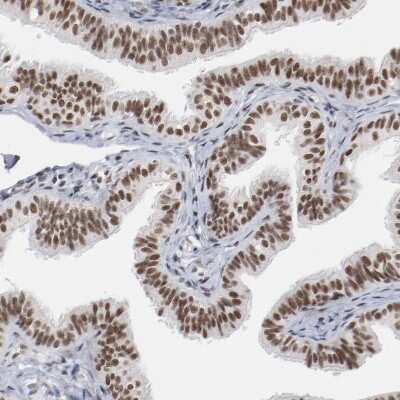 Immunohistochemistry-Paraffin: Bub3 Antibody [NBP1-88517]