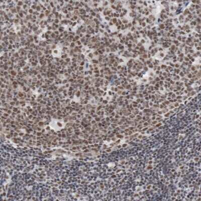 Immunohistochemistry-Paraffin: Bub3 Antibody [NBP1-88517]
