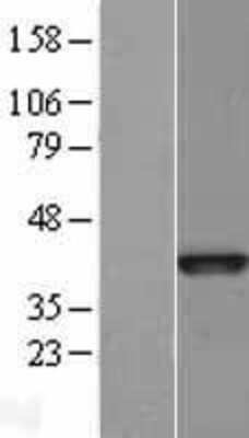 Western Blot: Bub3 Overexpression Lysate [NBL1-08058]