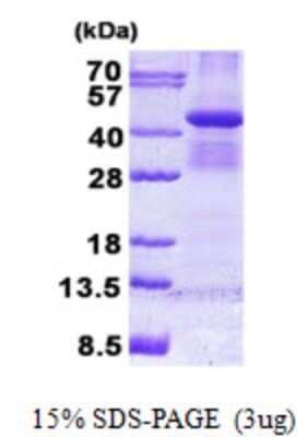 SDS-PAGE: Recombinant Human Bub3 His Protein [NBP2-22719]