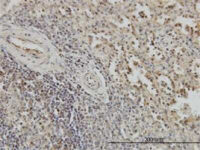 Immunohistochemistry-Paraffin: BubR1 Antibody (2G5) [H00000701-M02]
