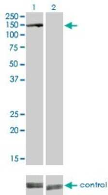 Western Blot: BubR1 Antibody (2G5) [H00000701-M02]