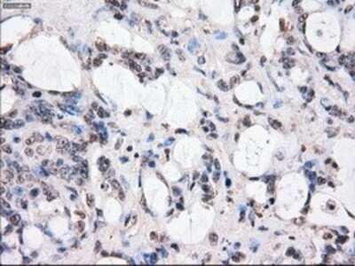 Immunohistochemistry-Paraffin: BubR1 Antibody (OTI6E5) [NBP1-47680]