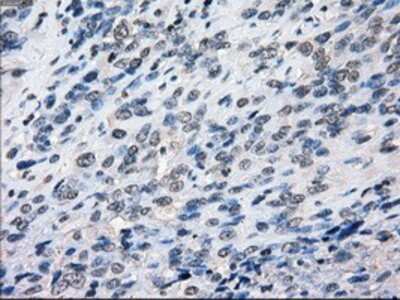 Immunohistochemistry-Paraffin: BubR1 Antibody (OTI6E5) [NBP1-47680]