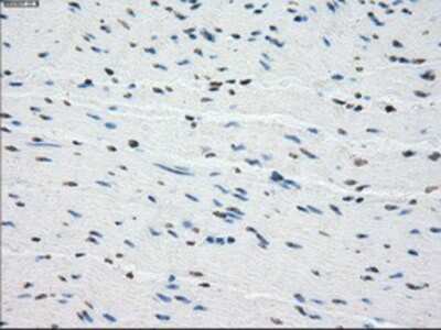 Immunohistochemistry-Paraffin: BubR1 Antibody (OTI6E5) [NBP1-47680]