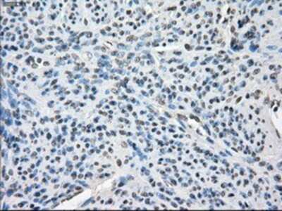 Immunohistochemistry-Paraffin: BubR1 Antibody (OTI6E5) [NBP1-47680]