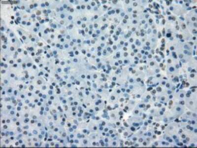 Immunohistochemistry-Paraffin: BubR1 Antibody (OTI6E5) [NBP1-47680]