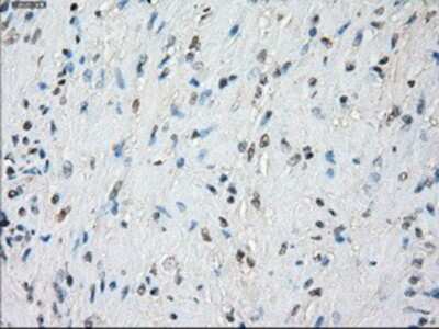 Immunohistochemistry-Paraffin: BubR1 Antibody (OTI6E5) [NBP1-47680]