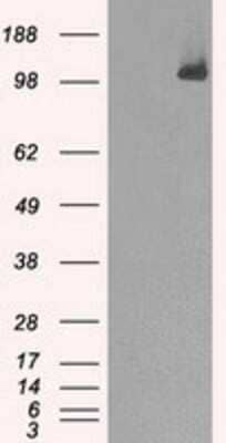 Western Blot: BubR1 Antibody (OTI6E5) [NBP1-47680]