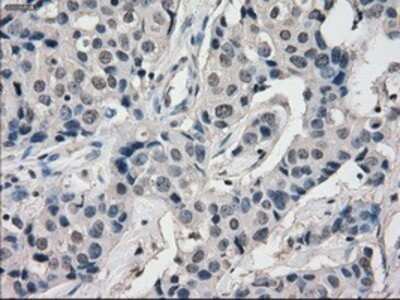 Immunohistochemistry: BubR1 Antibody (OTI6E5) - Azide and BSA Free [NBP2-70314]