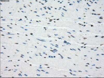 Immunohistochemistry: BubR1 Antibody (OTI6E5) - Azide and BSA Free [NBP2-70314]