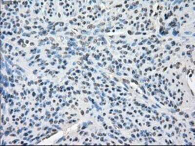 Immunohistochemistry: BubR1 Antibody (OTI6E5) - Azide and BSA Free [NBP2-70314]