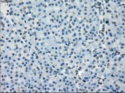 Immunohistochemistry: BubR1 Antibody (OTI6E5) - Azide and BSA Free [NBP2-70314]