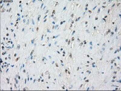 Immunohistochemistry: BubR1 Antibody (OTI6E5) - Azide and BSA Free [NBP2-70314]